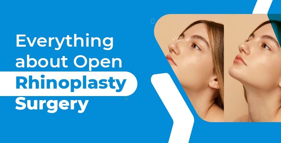 everything-about-open-rhinoplasty