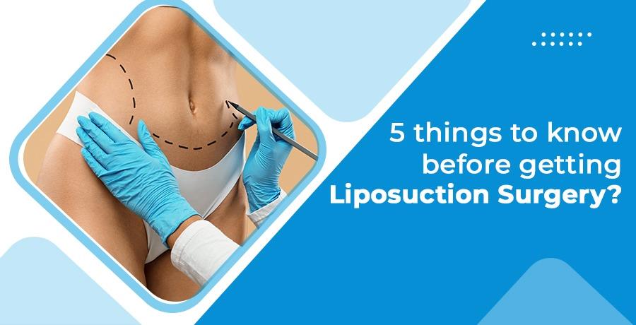 liposuction-surgery-in-delhi