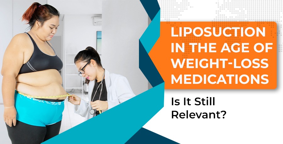 Liposuction in the Age of Weight-Loss Medications