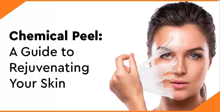 benefits-of-chemical-peel