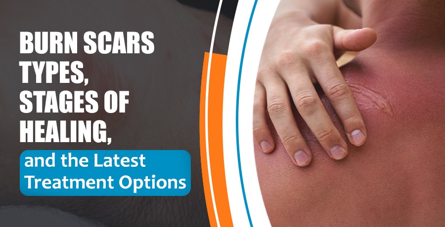 Burn Scars: Types, Stages, and the latest treatment