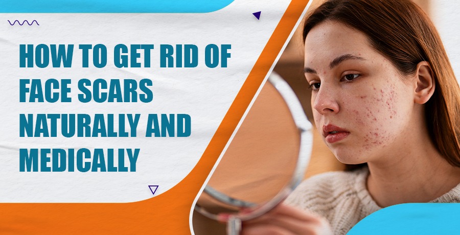 Get Rid of Face Scars Naturally and Medically