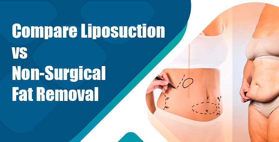 Liposuction vs Non-Surgical Fat Removal