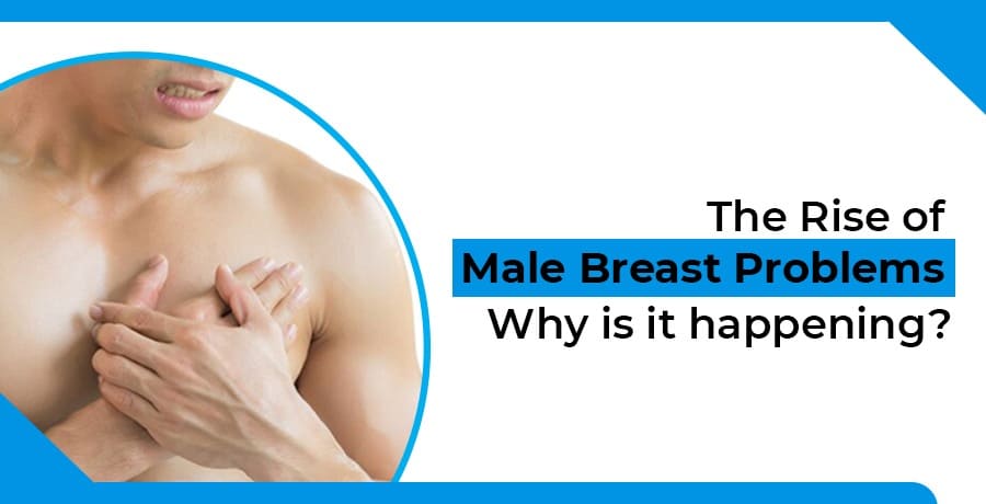 What causes man boobs? Ask The Expert