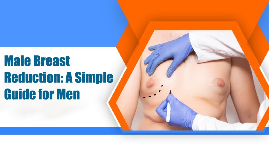 Male Breast Reduction