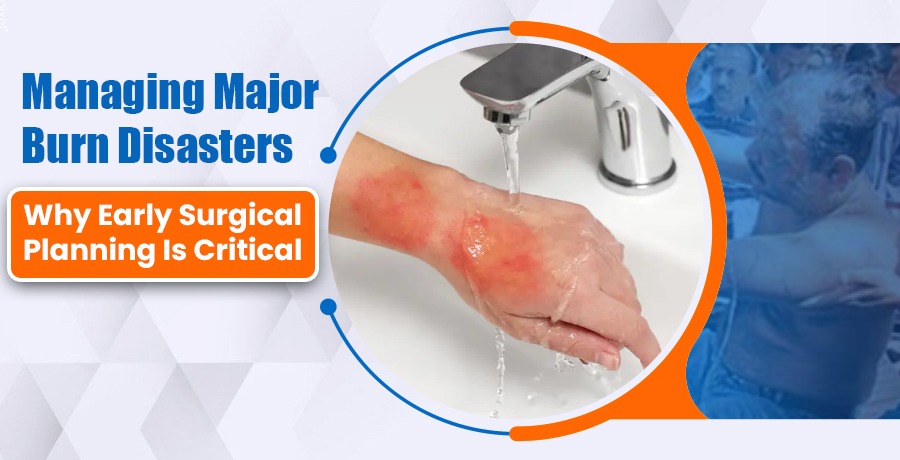 Managing Major Burn Disasters