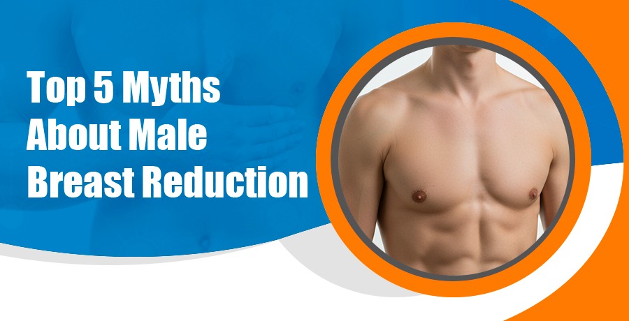 Myths About Male Breast Reduction