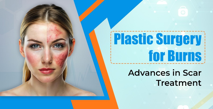 Plastic Surgery for Burns