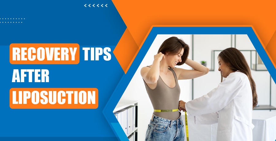 Recovery Tips After Liposuction