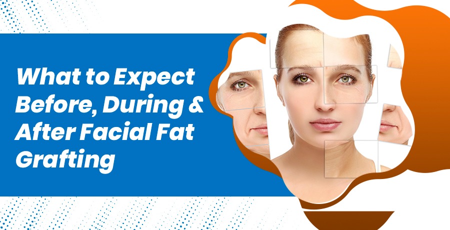 Step-by-Step Facial Graft