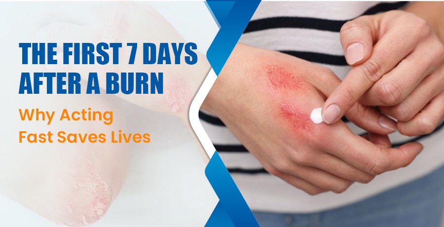 The First 7 Days After a Burn