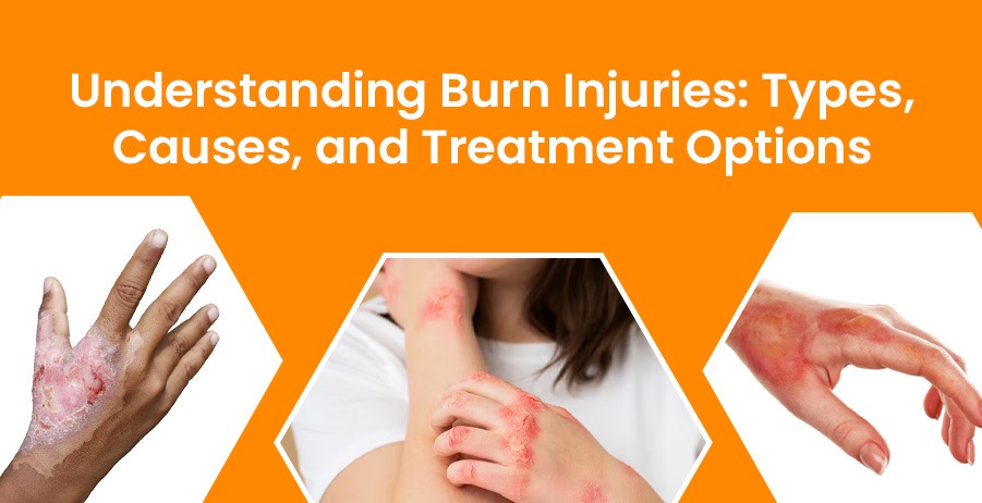 Understanding Burn Injuries