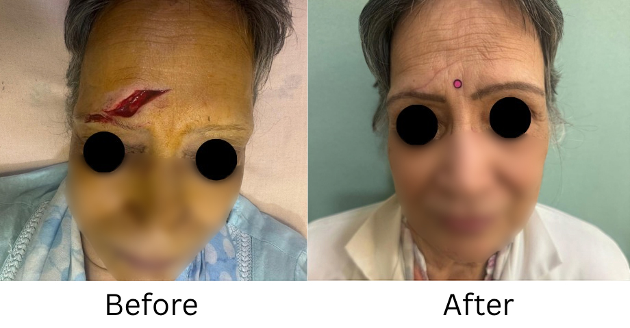 Trauma Repair