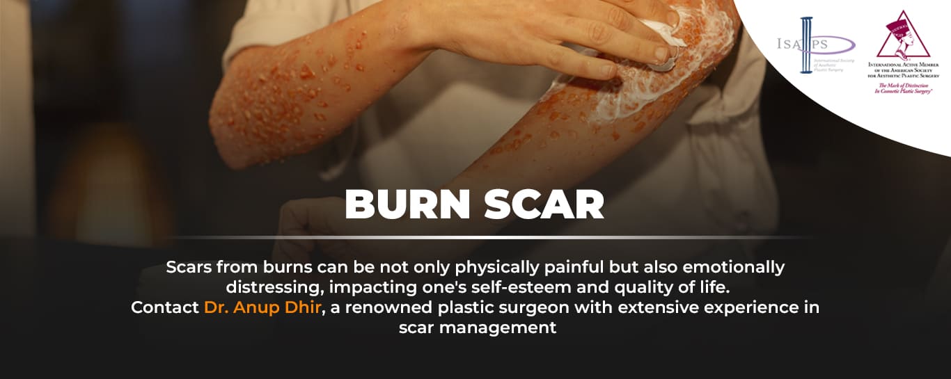 Burn-scar