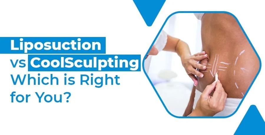 liposuction-vs-coolsculpting