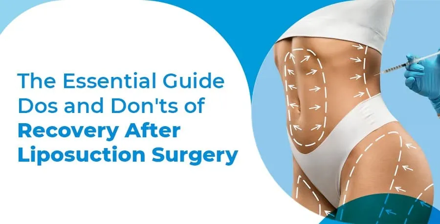 recovery-after-liposuction-surgery